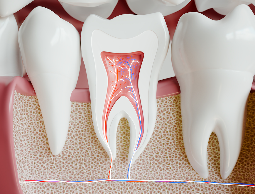 根幹治療イメージ